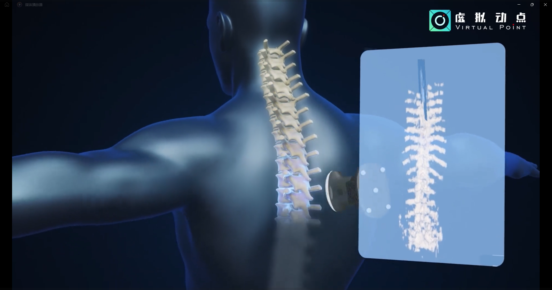 德赢VWIN·虚拟动点OptiTrack开创3D超声成像在脊柱诊断中的应用